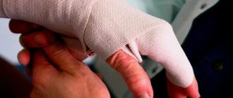 Травма на «удаленке»: когда домашний перелом становится проблемой работодателя?